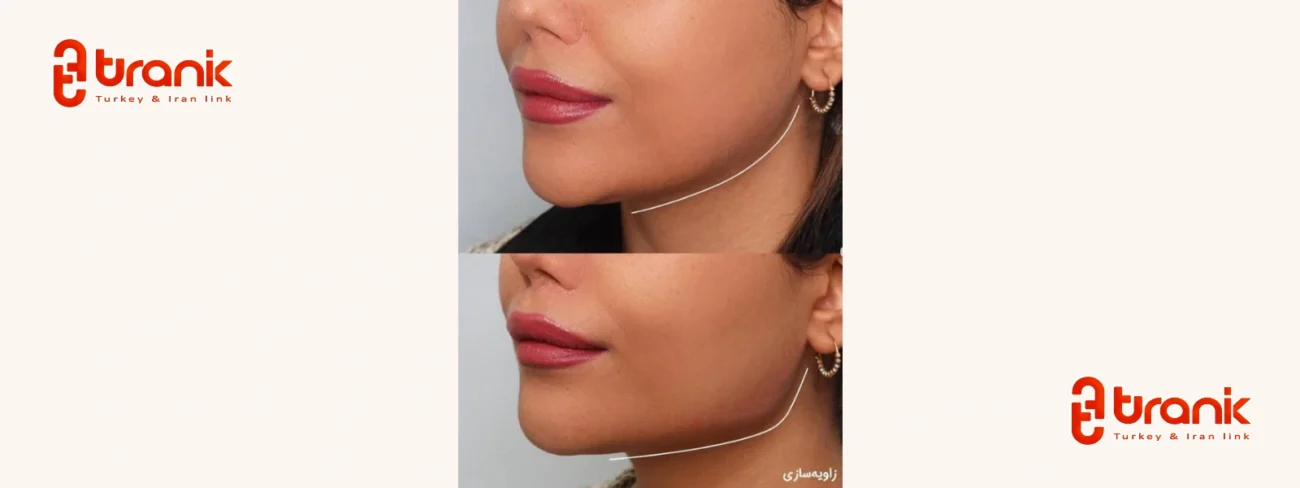 مرکز تخصصی زیبایی مینل در استانبول