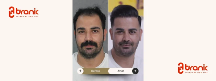 کلینیک گردشگری سلامت و زیبایی در استانبول