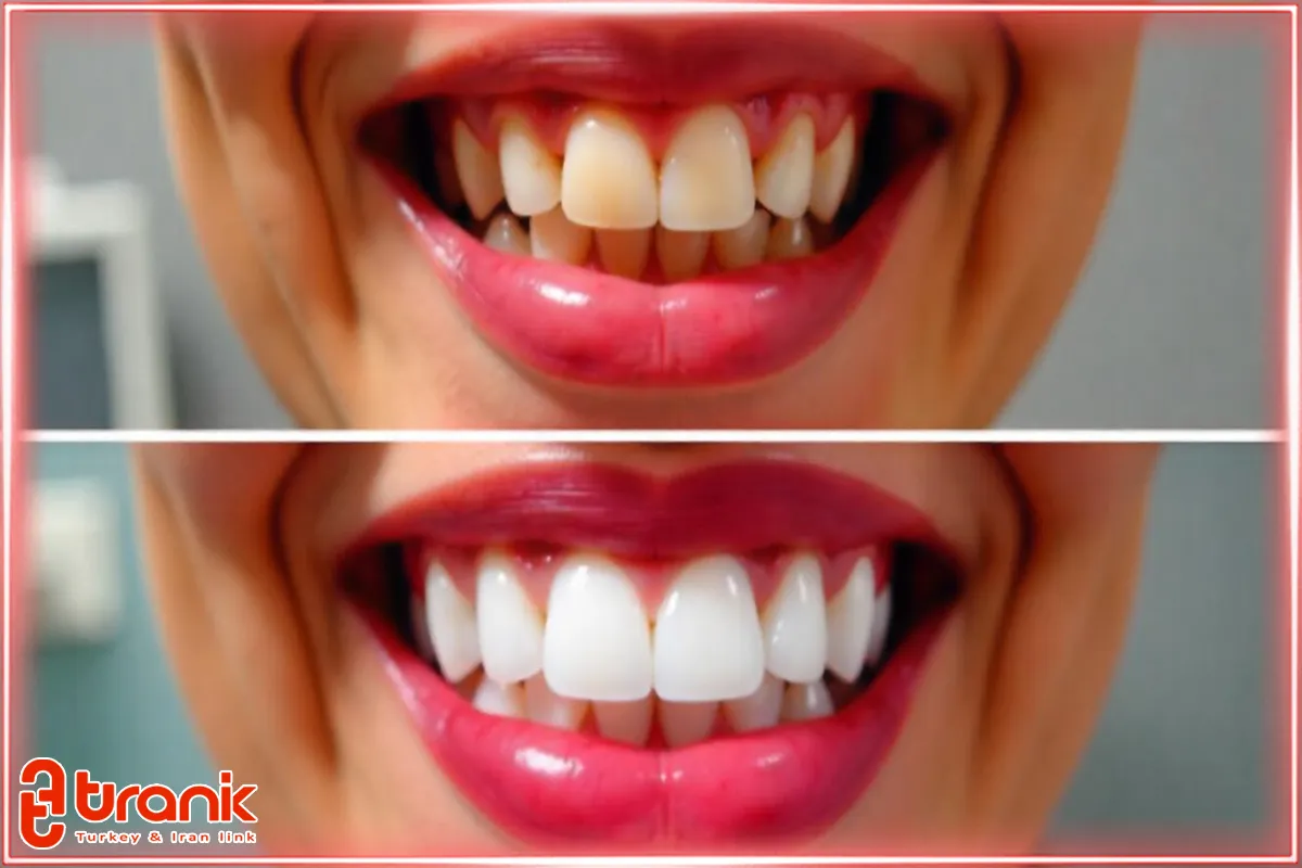 هزینه خدمات دندانپزشکی