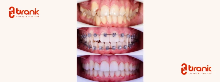 نمونه کار دکتر علی رضا تقوی