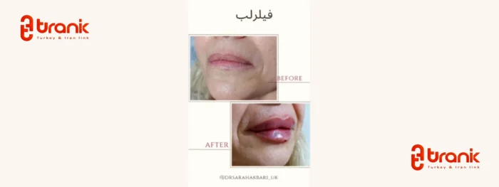 کلینیک زیبایی سارا