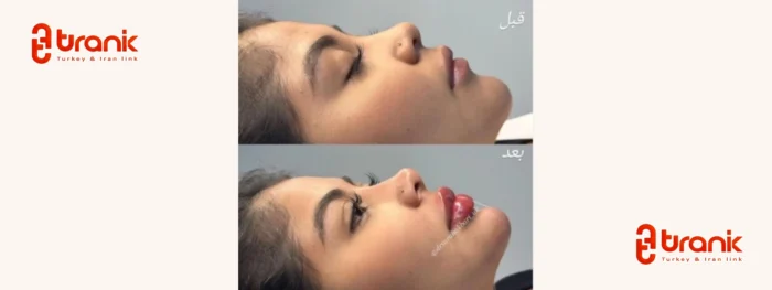 کلینیک زیبایی آنتالیا